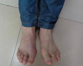 经我院治疗后 经我院治疗后