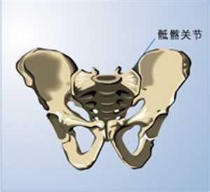 骶髂关节发展到强直性脊柱炎要多久