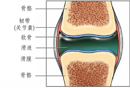 滑膜炎的原理跟治疗方法