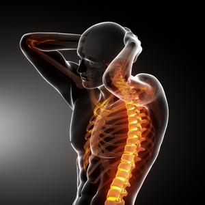 强直性脊柱炎患者平时锻炼要注意什么?郑州治疗强直医院专家介绍