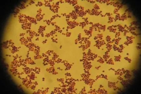 第21个世界关节炎日,你的关节保护好了吗? 第21个世界关节炎日,你的关节保护好了吗?
