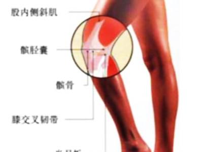 滑膜炎要怎么治疗才能 ?
