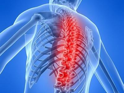 强直性脊柱炎除了对脊椎有伤害外，还可能会伤害什么？