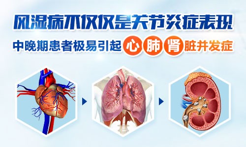 各种并发症 各种并发症