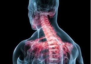 强直性脊柱炎危害颈椎措手不及，护理工作可不简单！