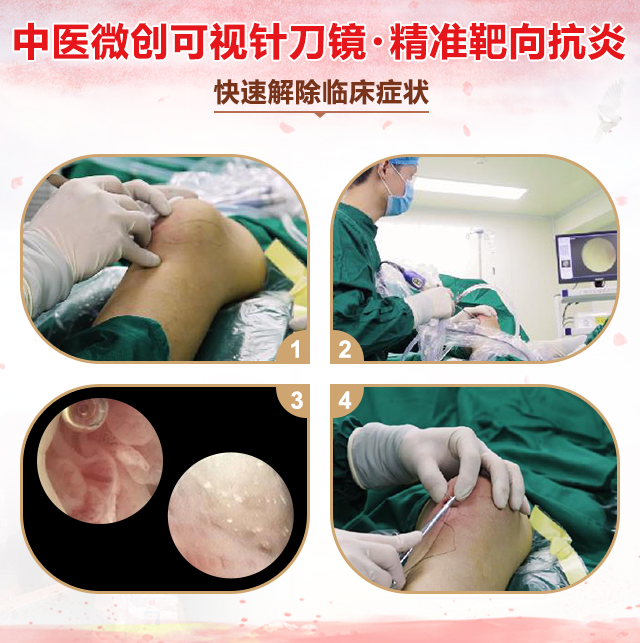 中医微创可视针刀镜·精准靶向抗炎,快速解除临床症状 中医微创可视针刀镜·精准靶向抗炎,快速解除临床症状.jpg