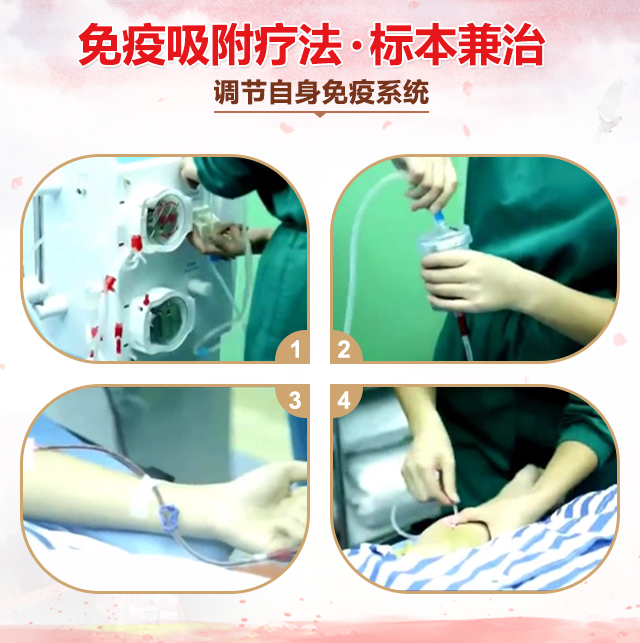 免疫吸附疗法 免疫吸附疗法.jpg
