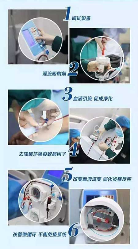 免疫吸附技术步骤解析图 关节免疫吸附技术
