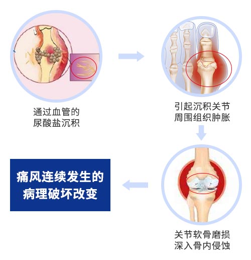 肌骨超声技术原理 新一代肌骨超声技术
