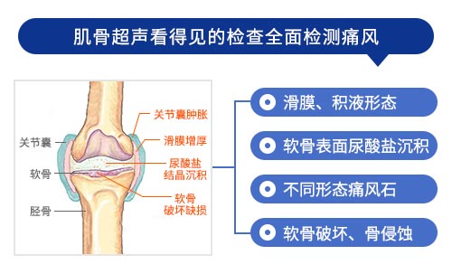 肌骨超声技术检查 新一代肌骨超声技术