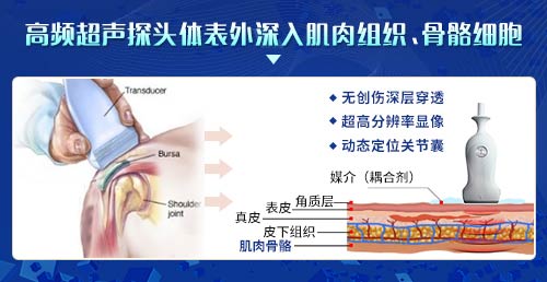 新一代MSUS肌骨超声技术临床应用 欧美新一代MSUS肌骨超声技术临床应用