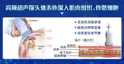 欧美新一代MSUS肌骨超声技术临床应用