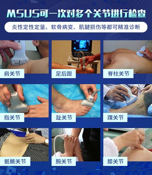 肌骨超声技术临床应用 欧美新一代MSUS肌骨超声技术临床应用