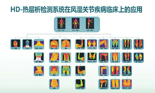 HD-热层析检测系统临床应用 HD-热层析检测系统