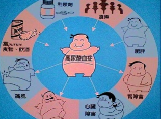 的痛风如何惹起 “年轻”的痛风如何惹起