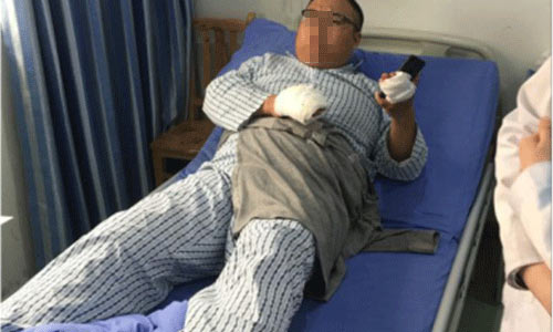 患者术后关节痛风石减少,疼痛感减少 25岁年轻小伙深受痛风折磨 根本性治疗不再反复