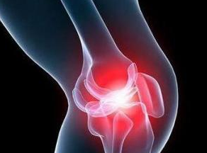 膝盖发病，痛得要命!滑膜炎是怎么引起的呢?