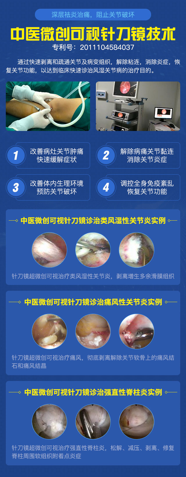 新技术成果巡礼丨中医微创可视针刀镜中原地区临床应用新闻发布会暨“420全民关注痛风日”大型联合会诊 新技术成果巡礼丨中医微创可视针刀镜中原地区临床应用新闻发布会暨