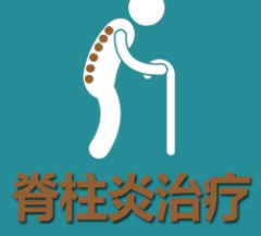 强直性脊柱炎会影响生育吗?郑州强直医院哪家好?