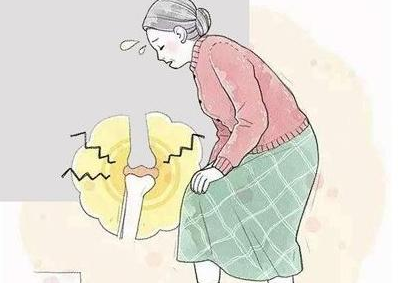 得了内风湿怎么办?郑州踝关节风湿治疗哪里好